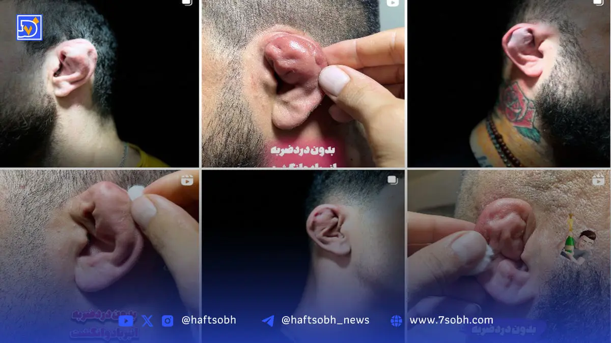 چند میگیری گوش بشکنی؟ | درباره پدیده عجیب شکستن عمدی گوش بین جوانان