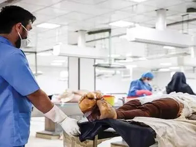 طی 9 ماهه نخست امسال 20 نفر به علت سوختگی در استان جان باختند