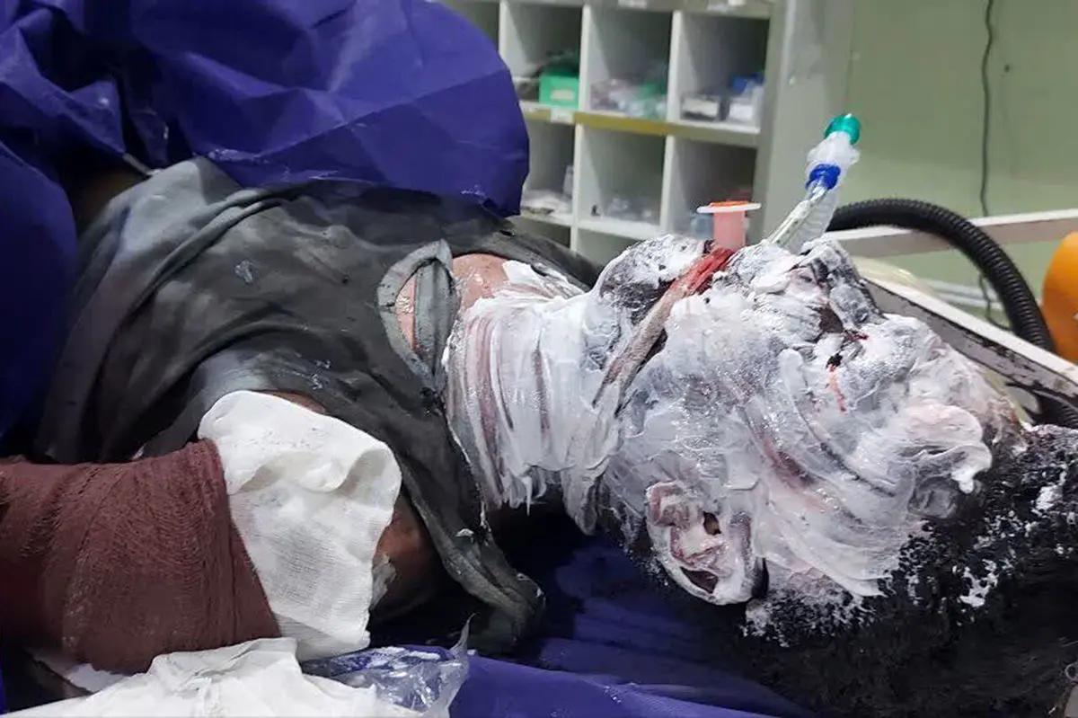 17 نفر در حوادث چهارشنبه‌سوری استان مرکزی مصدوم شدند