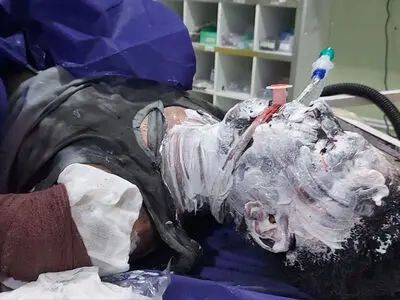 17 نفر در حوادث چهارشنبه‌سوری استان مرکزی مصدوم شدند
