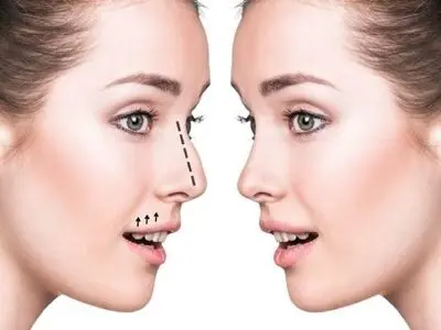 بهترین دکتر جراح بینی در کرج