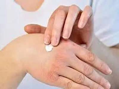 رفع خشکی پوست دست با چند راهکار خانگی