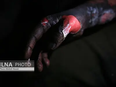 خارج شدن ۴ آمبولانس از چرخه عملیات