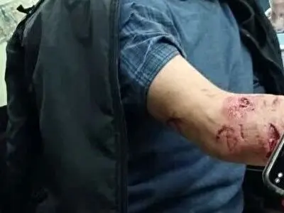 پلنگ یک دامدار اطاقوری را زخمی کرد