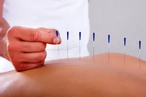 طب سوزنی برای سیاتیک؛ آیا سوزن‌ها از قرص‌ها مؤثرترند؟