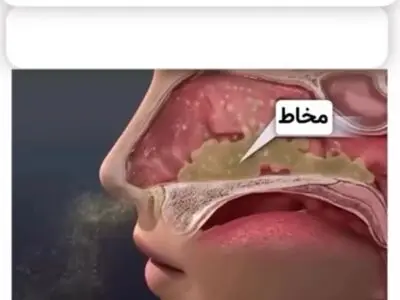 محلول آب و نمک به این شکل مجاری تنفسی و بینی را پاک سازی میکند + فیلم
