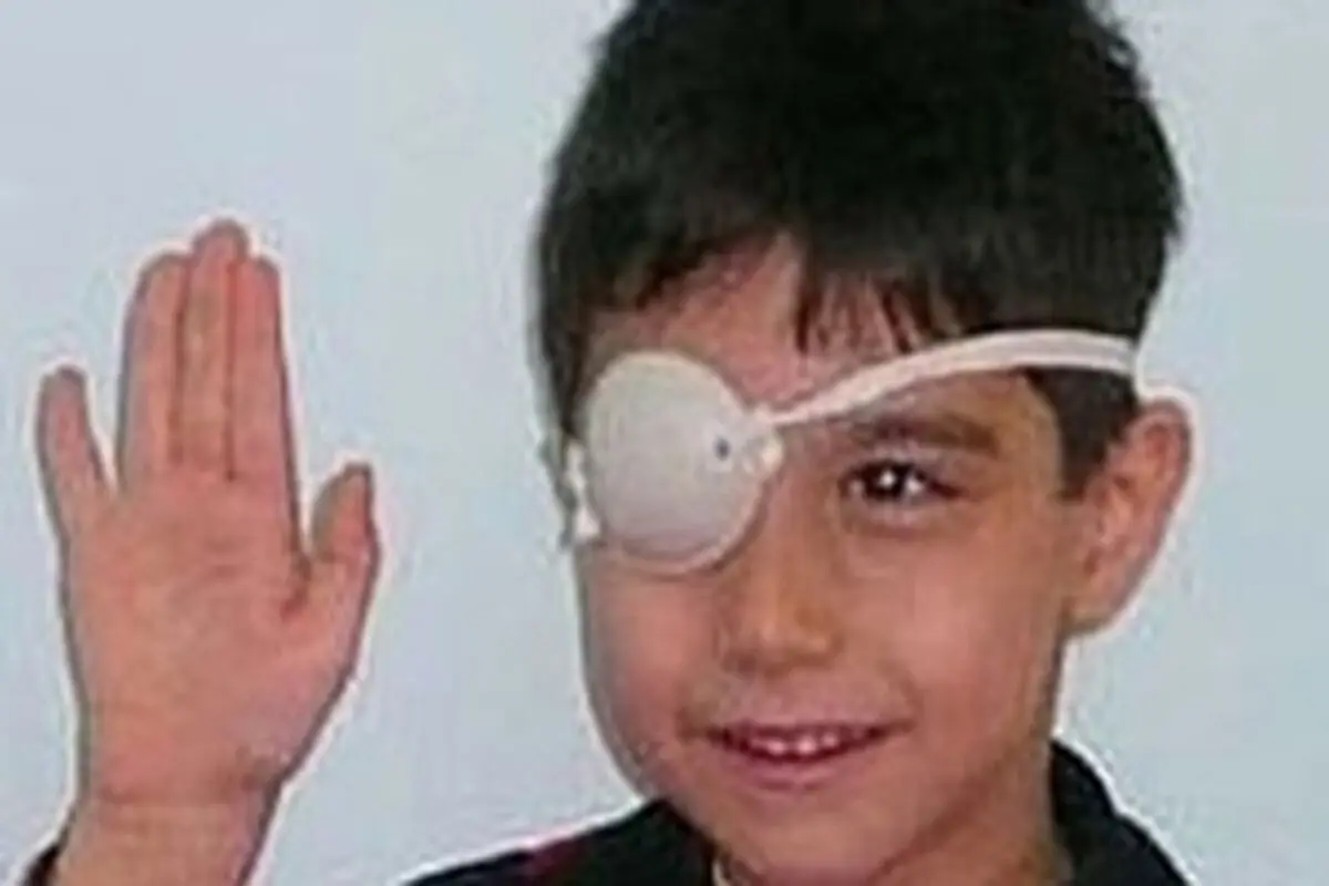 اجرای طرح پیشگیری از تنبلی چشم در سمنان آغاز شد