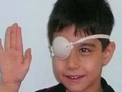 اجرای طرح پیشگیری از تنبلی چشم در سمنان آغاز شد