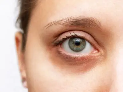 تشخیص بیماری از روی چشم ها+ فیلم