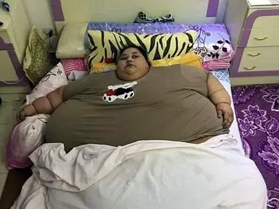 چاق‌ترین زن جهان با 500 کیلو وزن 