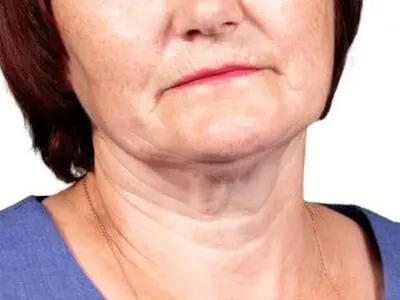 ترفندهای ساده برای رفع و جلوگیری از شلی پوست گردن