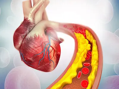 آیا باید از کلسترول و تری‌گلیسیرید بالا ترسید؟