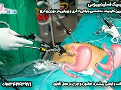 کلینیک اسلیم بیوتی؛ پیشرو در جراحی‌های لاغری و زیبایی