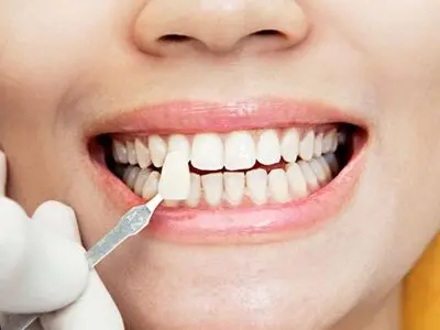 راهنمای جامع هزینه ‌های ترمیم و زیبایی دندان