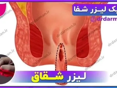 asdasd
