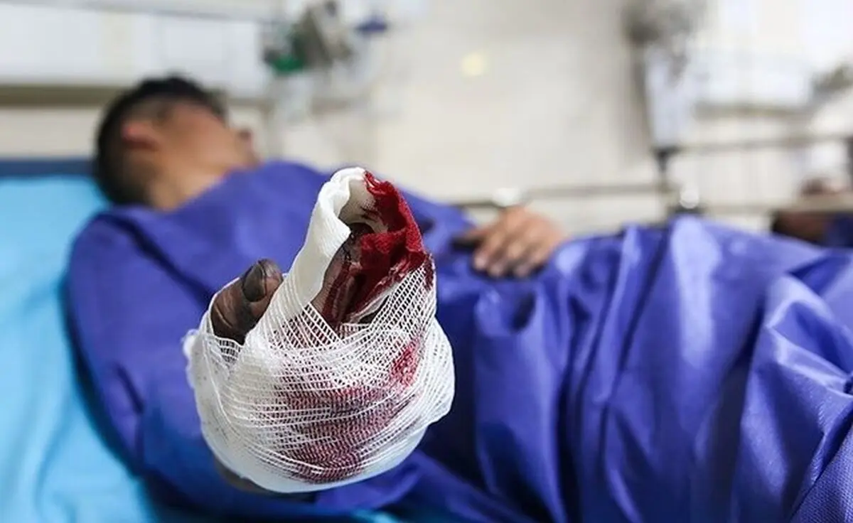 افزایش مصدومان چهارشنبه سوری کرمانشاه به ۵۹ نفر