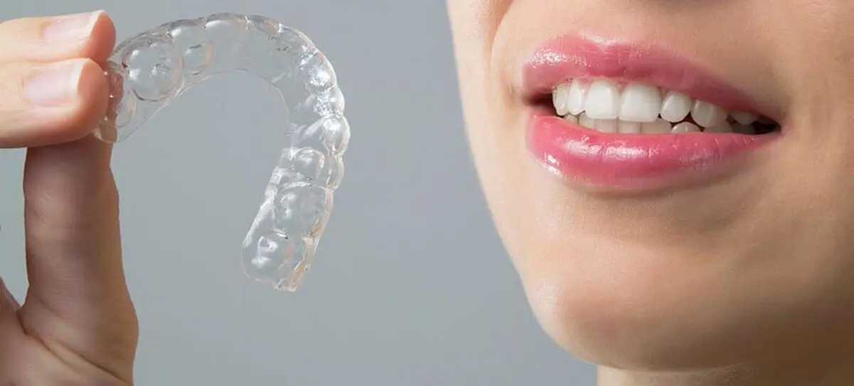 ارتودنسی نامرئی( پلاک‌های شفاف) چیست؟