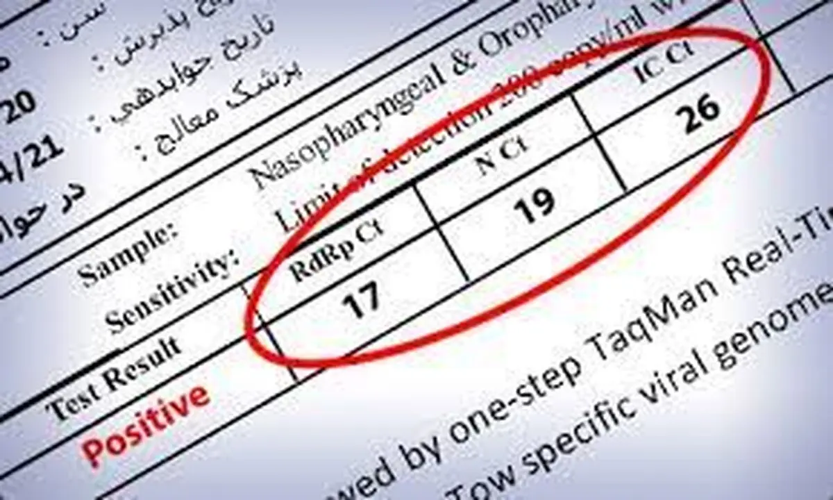 جعل آزمایش کرونا و استفاده از آن چه مجازاتی دارد؟