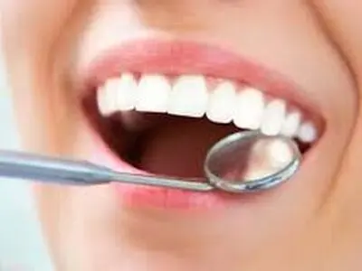 نکاتی برای حفظ سلامت دهان و دندان در طول روزه‌داری