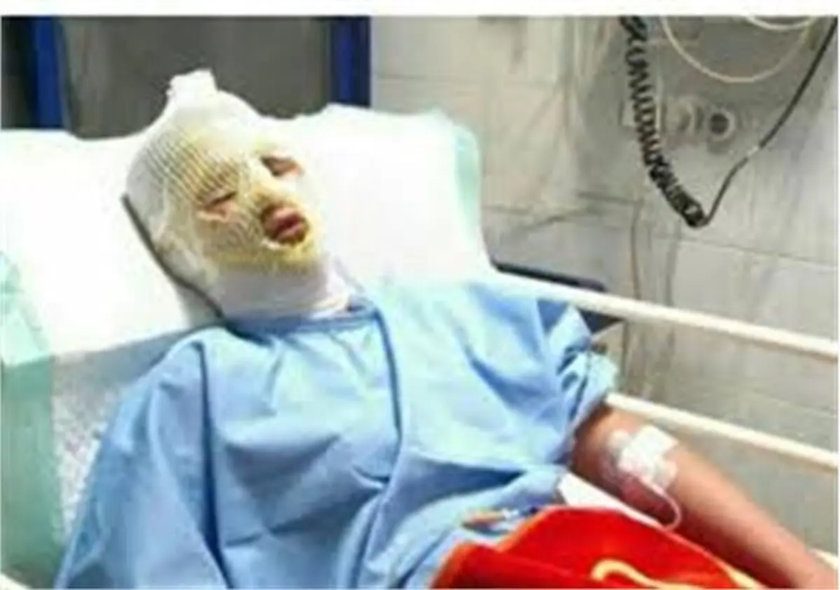 آخرین آمار مصدومان شب آخرین چهارشنبه سال در تهران