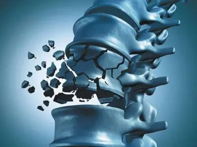 تقویت استخوان‌ها با مصرف منیزیم