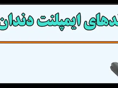 راهنمای جامع 2020 انواع برند ایمپلنت دندان+ قیمت و اینفوگرافیک 