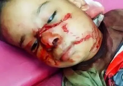 دادستان شوش دستور بررسی حادثه حمله سگ به کودک چهار ساله شوشی را صادر کرد