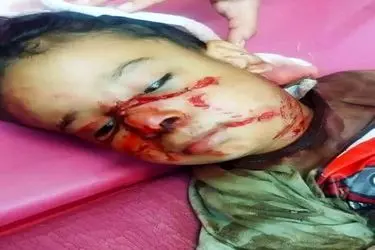 دادستان شوش دستور بررسی حادثه حمله سگ به کودک چهار ساله شوشی را صادر کرد