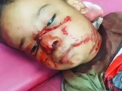 دادستان شوش دستور بررسی حادثه حمله سگ به کودک چهار ساله شوشی را صادر کرد